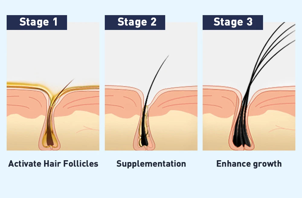 QiBest Wimpernwachstumsserum – Feuchtigkeitsspendend & Verlängerung