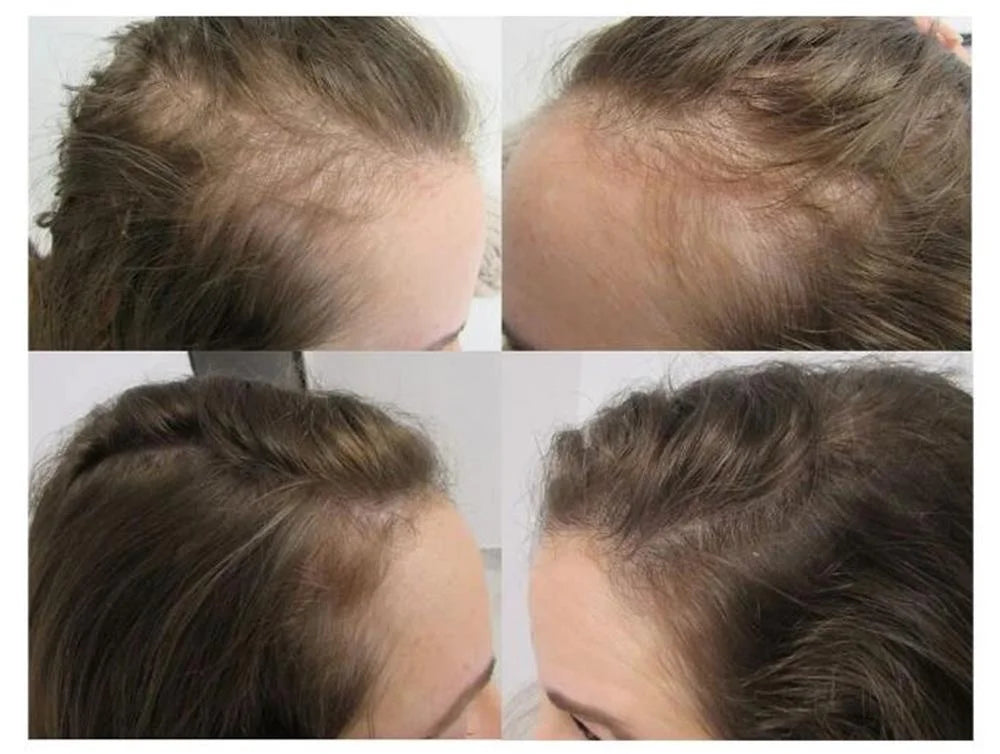Schnelles Wimpernwachstum Serum-7-Tage-Fuller-Lash-Behandlung