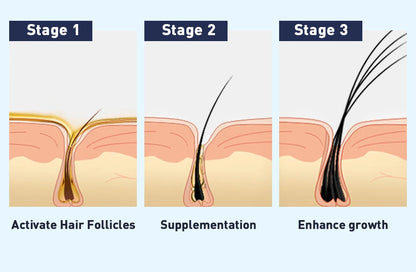 QiBest Wimpernwachstumsserum – Feuchtigkeitsspendend & Verlängerung